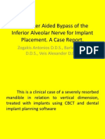 Computeinr Aided Bypass of The Inferior Alveolar Nerve