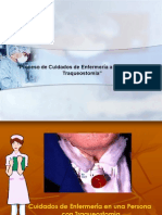 Proceso de Cuidados de Enfermería A Personas Con Traqueostomia