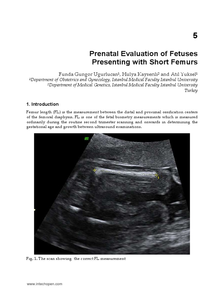 InTechPrenatal Evaluation of Fetuses Presenting With Short Femurs