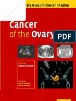 9827284 Ovarian Cancer