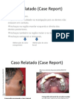 Caso Reportado (Case Report)