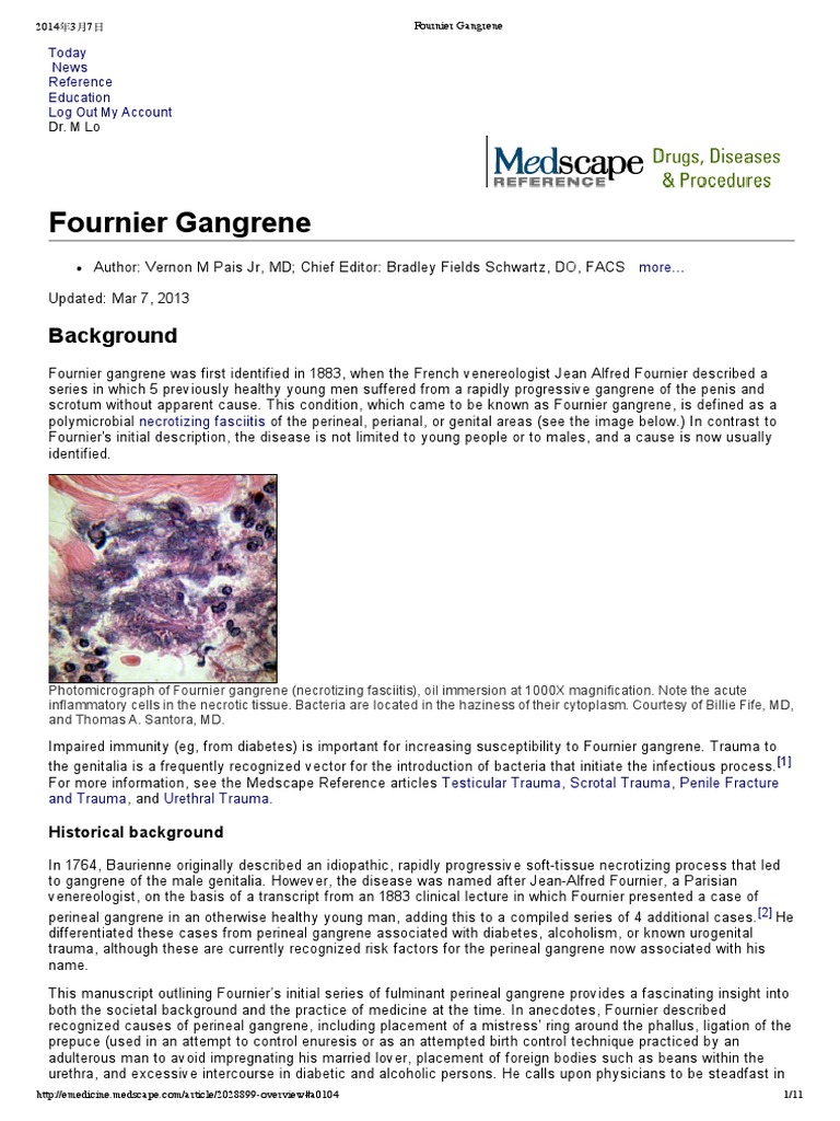 Fournier Gangrene | Abdomen | Clinical Medicine