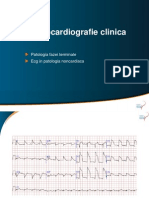 Atelier ECG 2