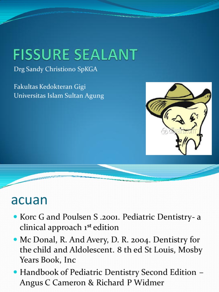 6. Fissure Sealant,Ppt