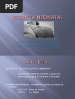 Ictericia Neonatal