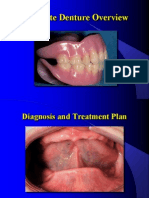 01. Complete Denture Overview