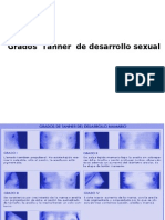 Grados Tanner de Desarrllo Sexual para EST - VII Enfermeria