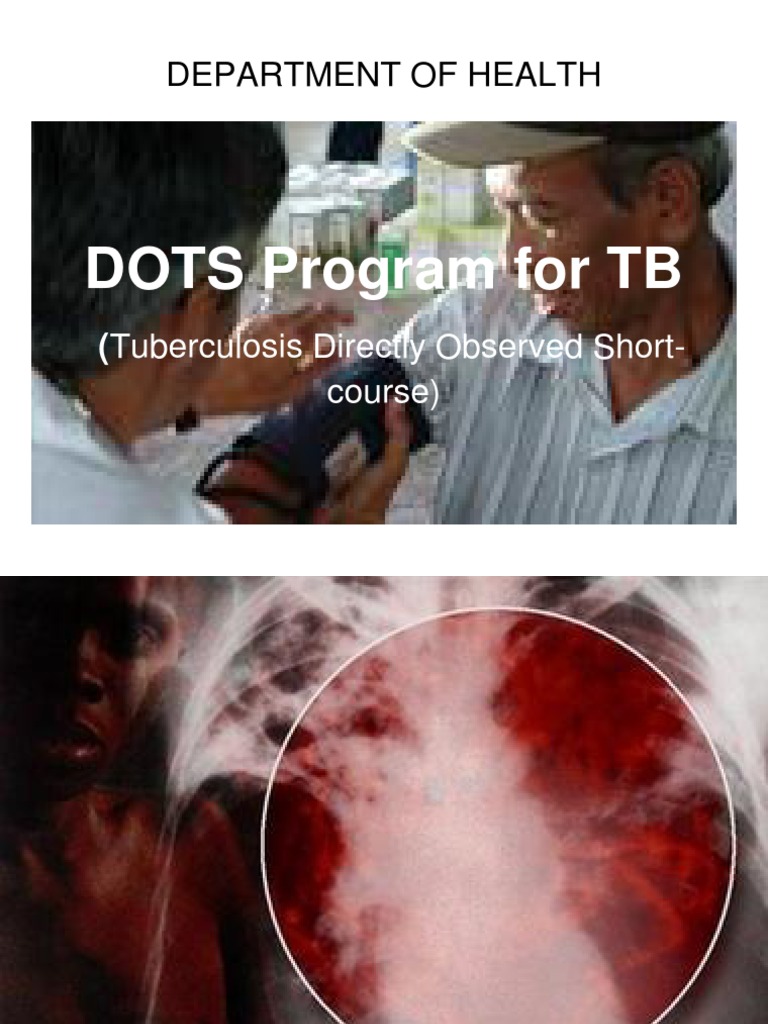 DOTS Program for Tuberculosis Control | PDF