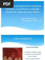 Duplo Cisto Periapical Em Maxila de Tamanho,