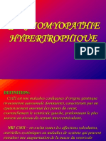 Cardiomyopathie Hypertrophique