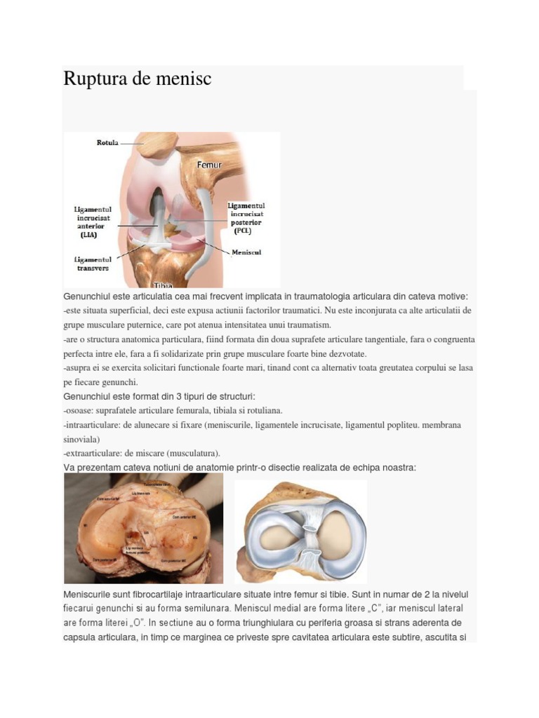 Menisc | PDF