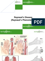 Raynauds Disease