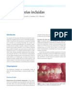 Factores de riesgo de inclusión dentaria