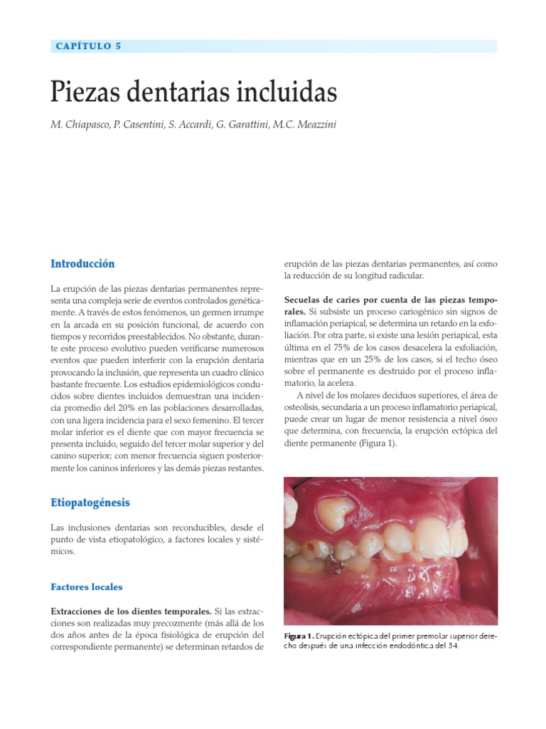 Dientes Incluidos | PDF | Diente humano | Especialidades Medicas