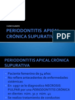 Periodontitis Apical Crónica Supurativa