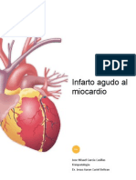 InfartoMiocardio