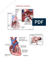 CARDIOPATIAS  CONGENITAS