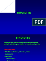 tiroidite