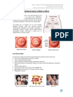 Cáncer cérvix VPH prevención Papanicolaou