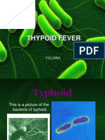 Thypoid Fever: Yuliana