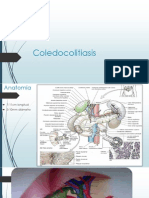 Coledocolitiasis