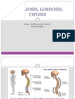 3escoliosis, Lordosis, Cifosis