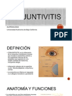 CONJUNTIVITIS ALERGOLOGIA