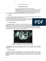 7.3. Pancreatita Cronica