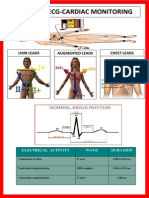 12 Leads Ecg-Cardiac Monitoring: Limb Leads Augmented Leads Chest Leads