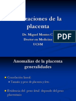 Placenta Circumbalada
