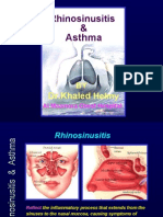 Lectures PPS Sinusitis - Pps
