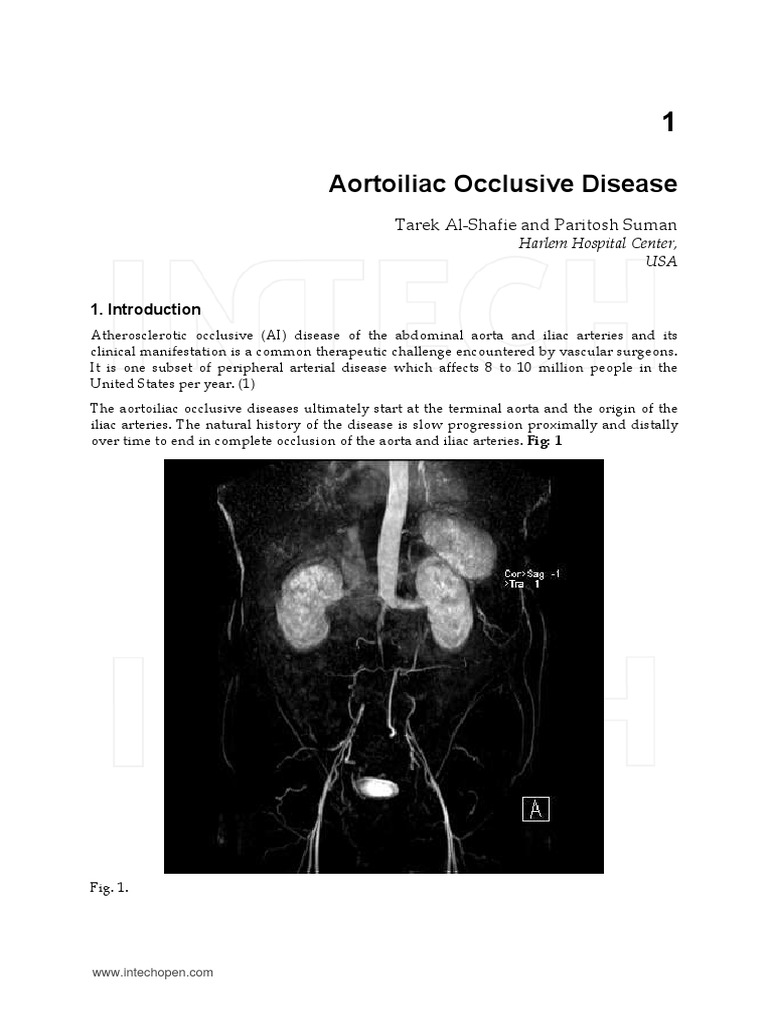Aortoiliac Occlusive Disease Angiography Ischemia