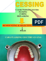Processing, Remounting & Selective Grinding
