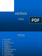 clase-hernia-inguinal-06-1225245957692663-9