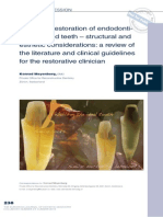 The Ideal Restoration of Endodontically Treated Teeth Structural and Esthetic Considerations a Review of the Literature and Clinical Guidelines for the Restorative Clinician
