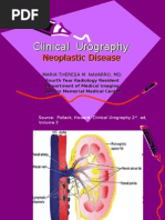 Renal Neoplasm 