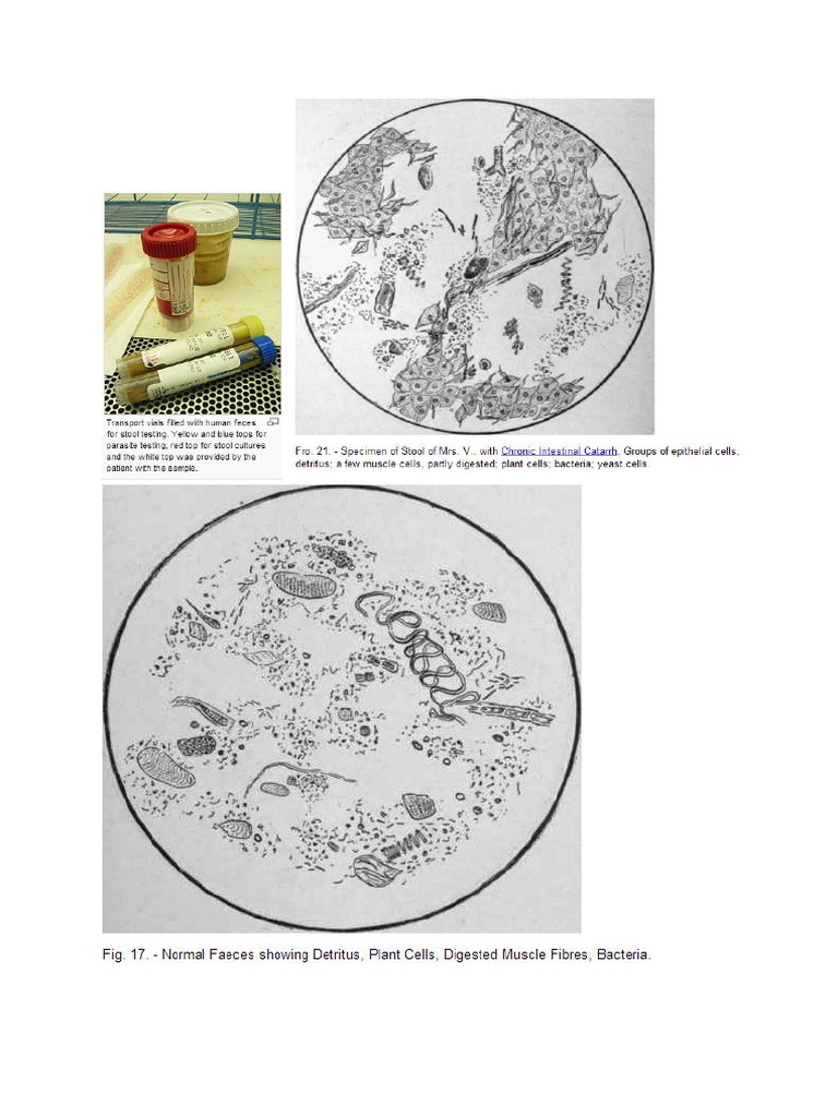 Pemeriksaan Mikroskopis Feses