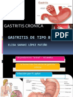 Gastritis de Tipo b1