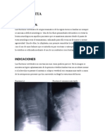 Cifoplastia y Vertebroplastia