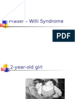 Prader - Willi Syndrome