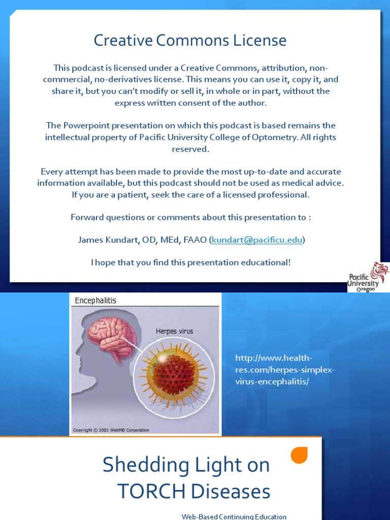 Torch Diseases Ce PDF Congenital Disorder Hiv/Aids