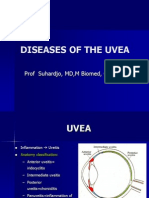 Diseases and Disorders of the Uvea and Lens