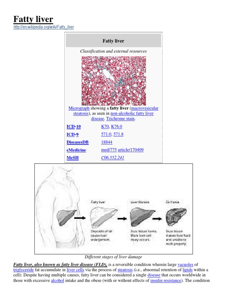 Non-Alcoholic Steato-Hepatitis - NASH (2013) Wikipedia-Medline ...