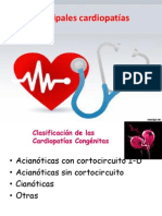 Principales Cardiopatías Congenitas