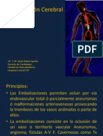 Embolizaciones