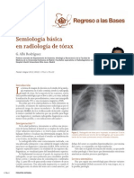 Radiologia de Torax