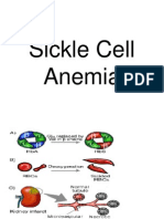 Sickle Cell Anemia