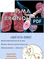 Asma Bronquial Síntomas y Tratamiento