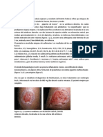 5 Casos Clinicos de Leishmaniasis