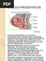 Download Breech Presentation by VijithVkumar SN215279111 doc pdf